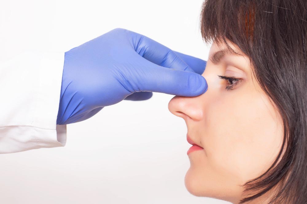 es normal verse la nariz torcida después de una rinoplastia — Dr. Javier Galindo