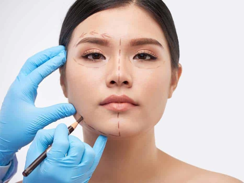 asimetria facial — Dr. Javier Galindo
