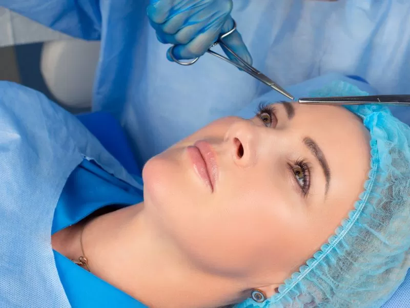 Blefaroplastia Superior — Dr. Javier Galindo Madrid