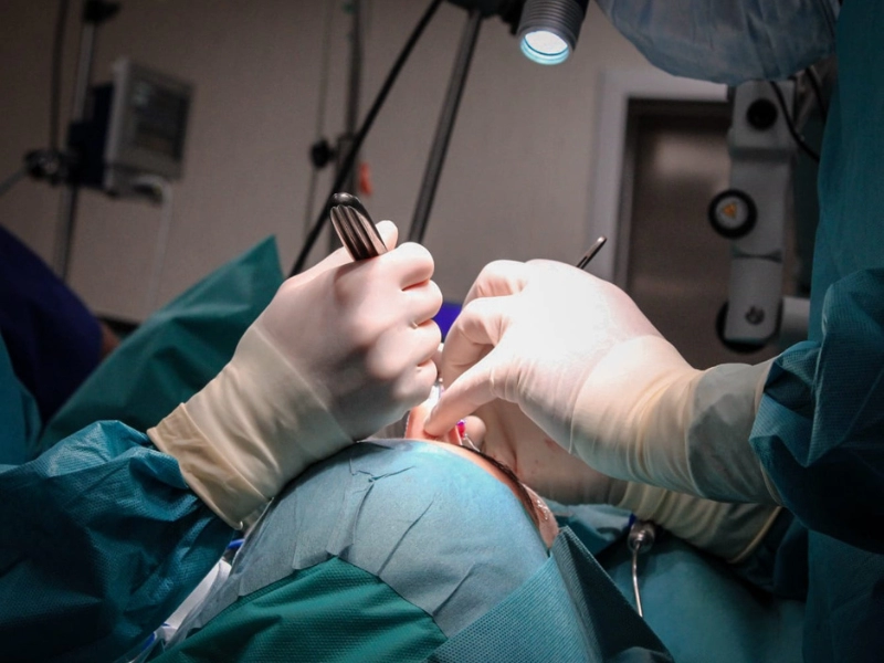 Cicatrices de una rinoplastia — Dr. Javier Galindo
