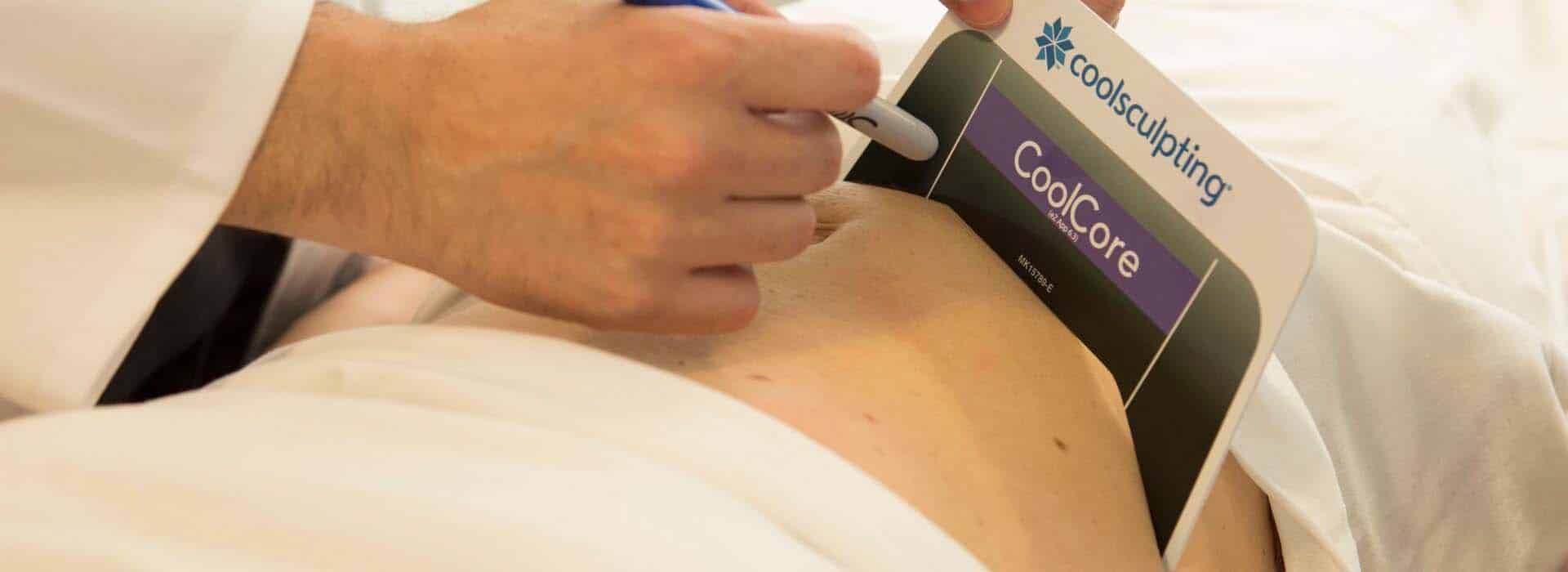 Antes y después de Coolsculpting® en mujeres — Dr. Javier Galindo