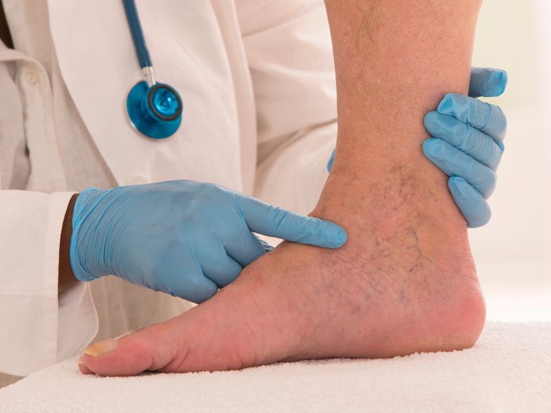láser vascular — Dr. Javier Galindo