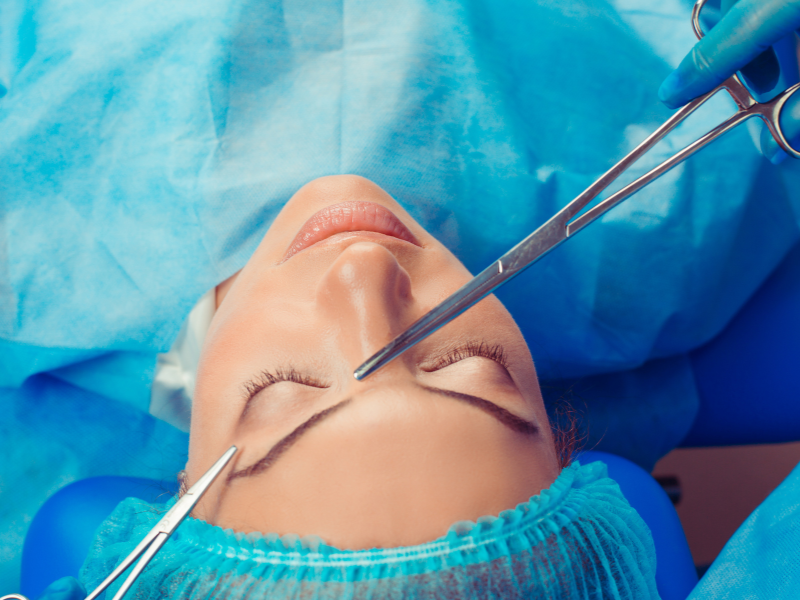 Lifting de cejas — Dr. Javier Galindo