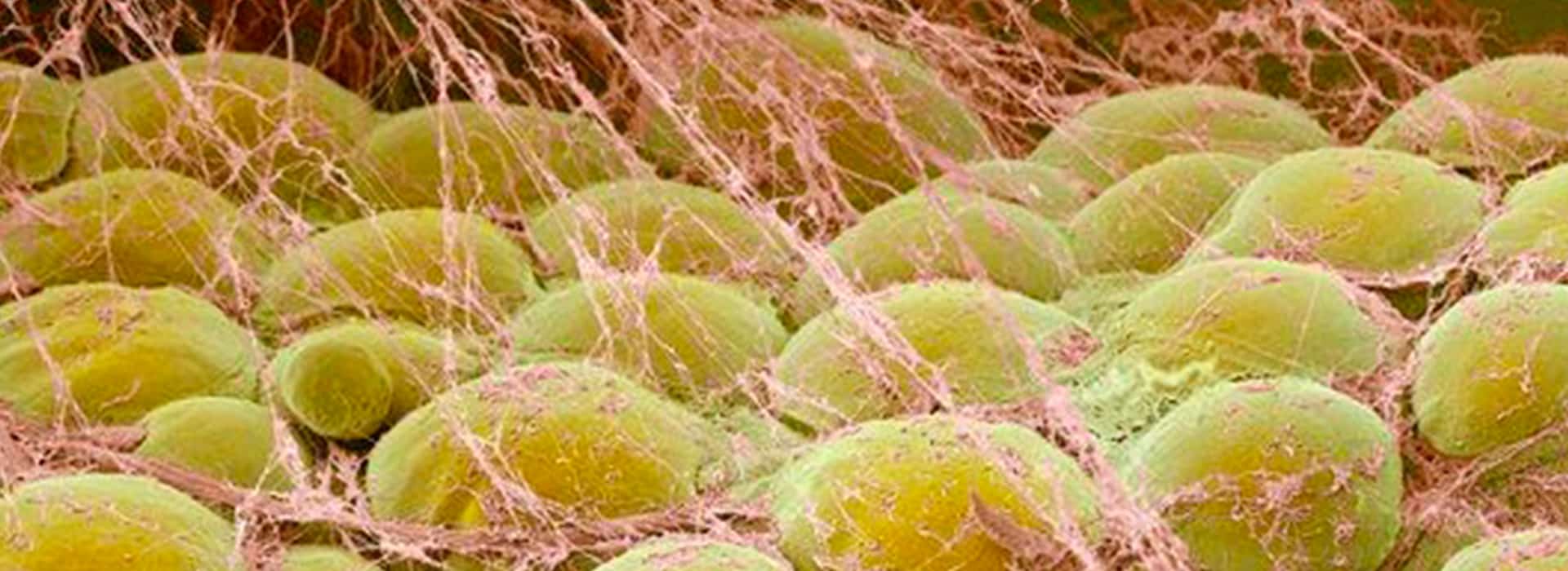 ¿Se reabsorbe la grasa inyectada después de un lipofilling? — Dr. Javier Galindo