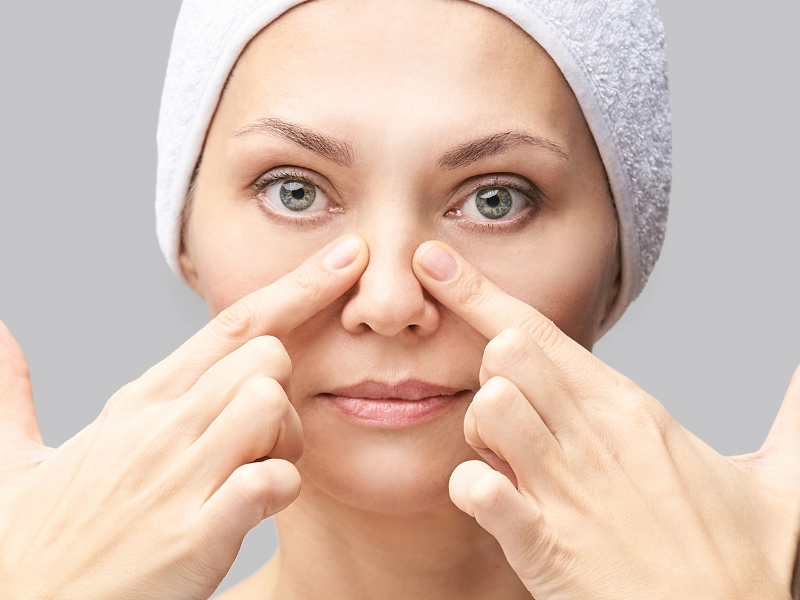 Punta de la nariz hinchada tras una rinoplastia, ¿por qué se produce? — Dr. Javier Galindo