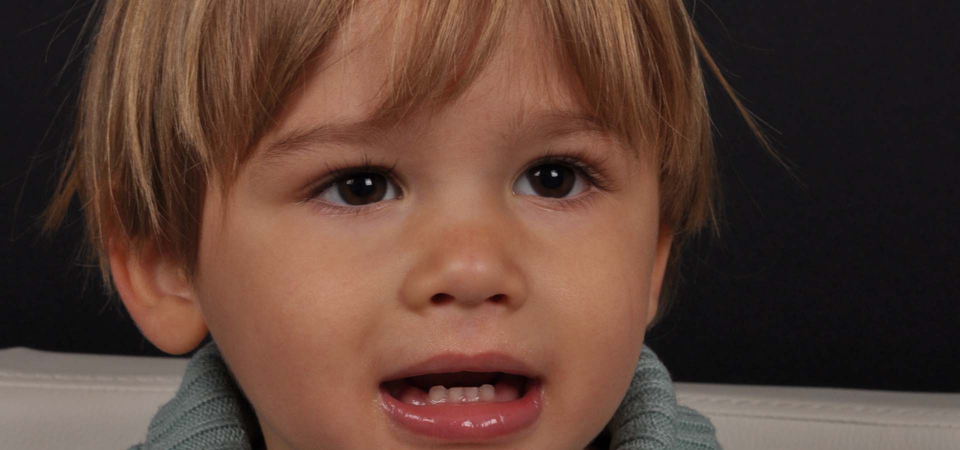 ¿Cómo Es La Nariz De Un Bebé? | Doctor Galindo