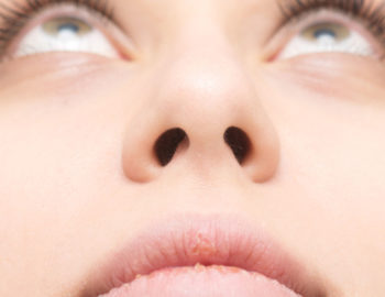 DrGalindo blog el cartilago de la nariz se deforma causas y tratamientos